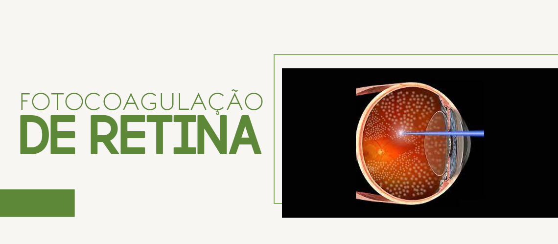 fotocoagulacao_retina